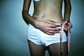 anorexia